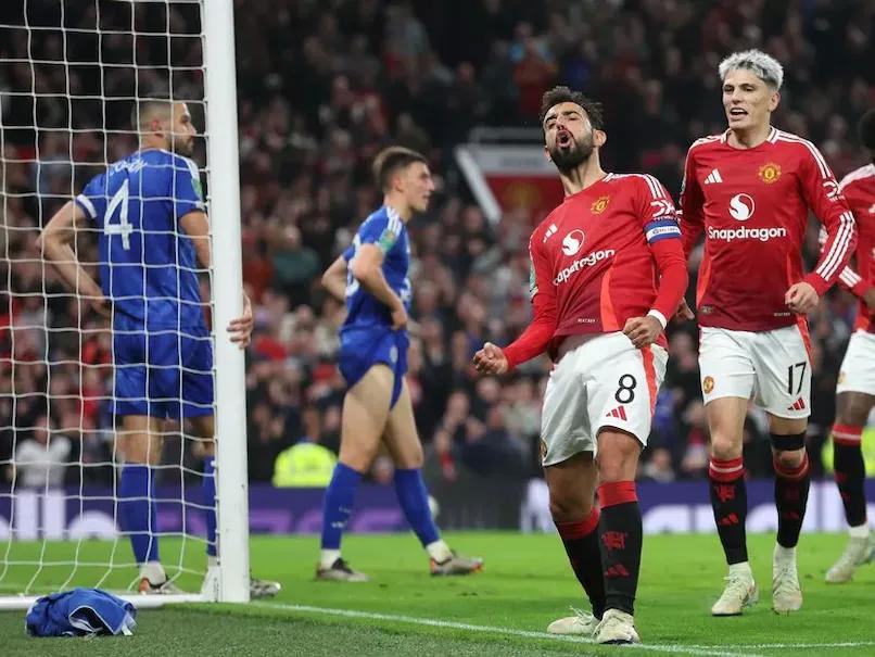 Manchester United vs Leicester City FA Cup Live Streaming: How to Watch Live Telecast and Where to Watch